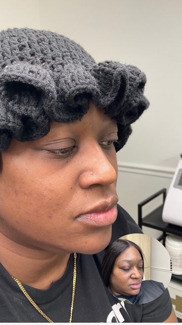 Facial Balancing