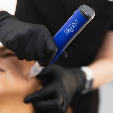 Microneedling Facial con SkinPen®