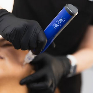 SkinPen® Facial Microneedling